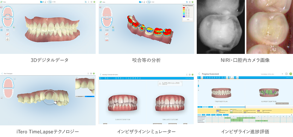 アイテロ５D