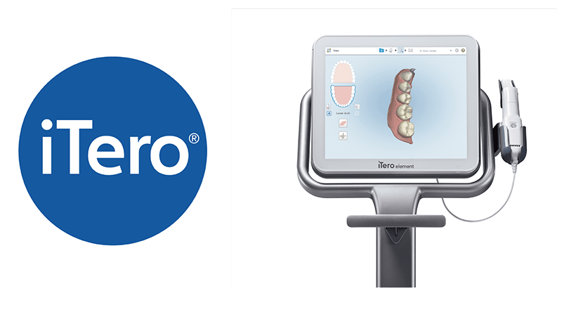iTero（アイテロ）で事前に治療のシミュレーションが可能